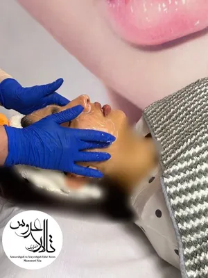پاکسازی پوست در کرمان/ تالار عروس منصوری نیا