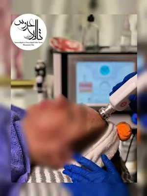 پاکسازی پوست در کرمان/ تالار عروس منصوری نیا