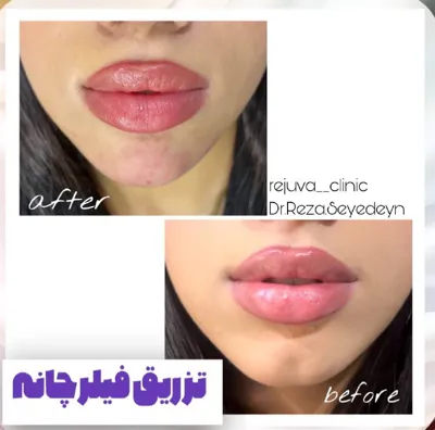                کلینیک زیبایی رژووا