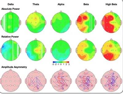 نقشه مغزی کودک پیش فعال و بهبود و درمان

در تیم چکاب در منزل 