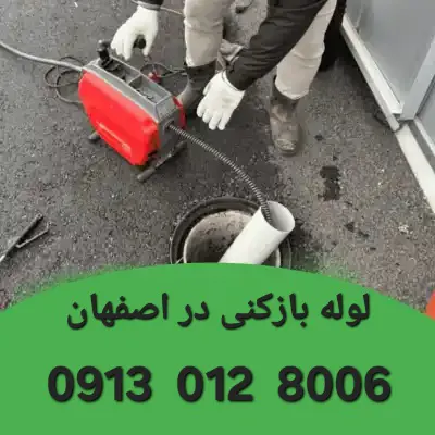 لوله بازکنی دنا