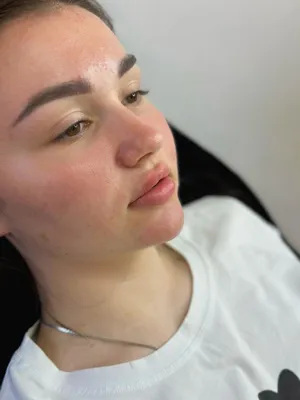 تزریق به لب نسیم شهر