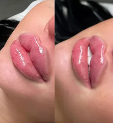 فیلر لب نسیم شهر