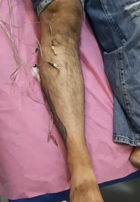 متخصص فیزیوتراپی در تهران