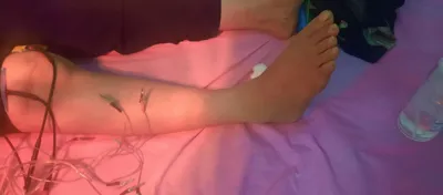 متخصص فیزیوتراپی در تهران