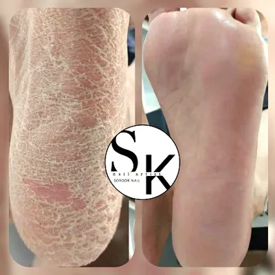 آموزش پدیکور 