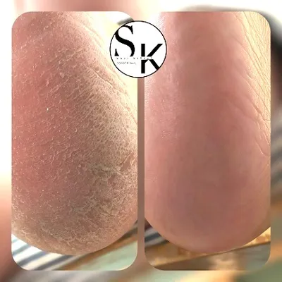 آموزش پدیکور در آموزشگاه کاشت ناخن در کرمان 