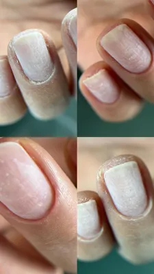 آموزش ترمیم ناخن