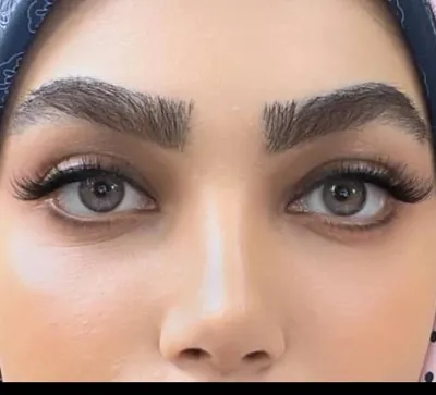 کاشت ابرو در تهران