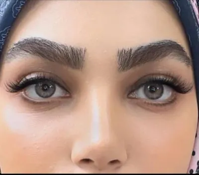 کاشت ابرو در تهران