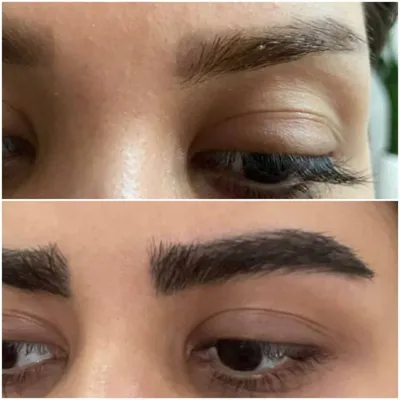 کاشت ابرو در تهران