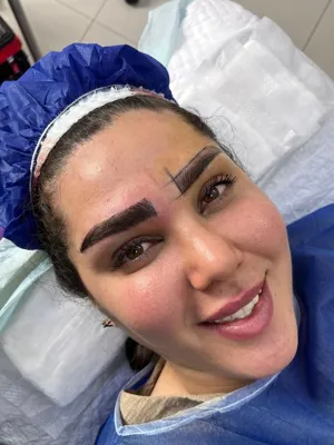 کاشت ابرو در تهران