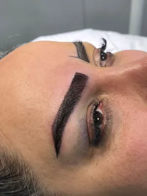 کاشت ابرو در تهران