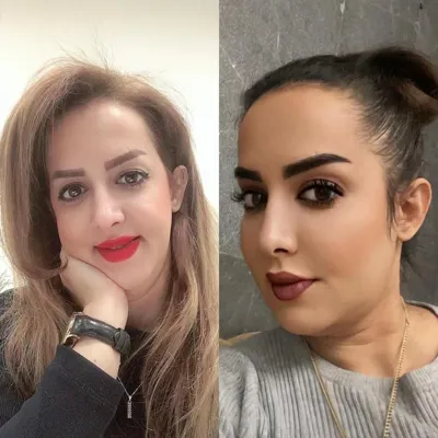 کاشت ابرو در تهران به