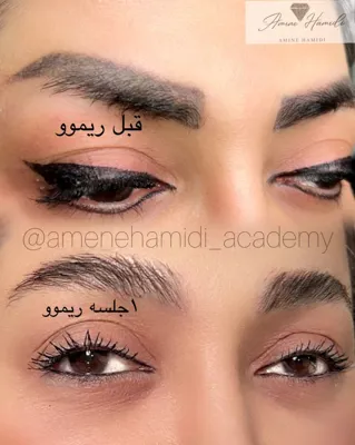 ریموو خط چشم