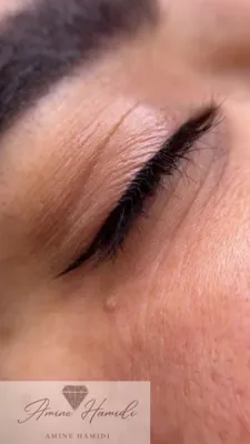 بن مژه ظریف