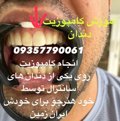 اموزشگاه دندانسازی در تهران