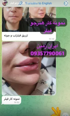 آموزش دندانسازی