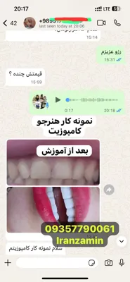آموزش حرفه ای دندانسازی در تهران