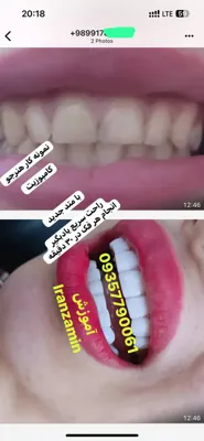 آموزشگاه دندانپزشکی در تهران