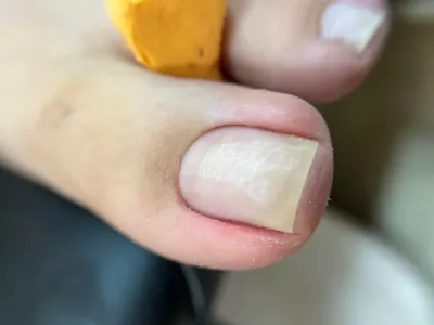 کاشت ناخن با ماندگاری بالا در اصفهان