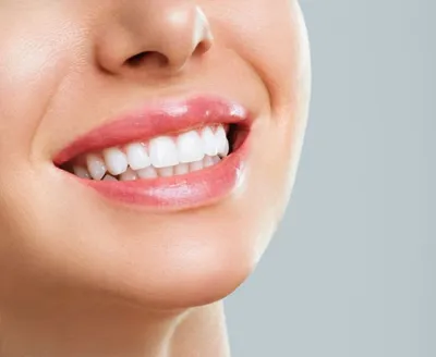 ایمپلنت دیجیتال 