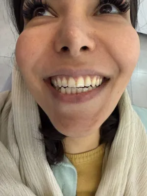 ایمپلنت دیجیتال 