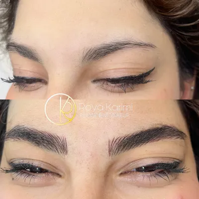 رویا کریمی کشکولی