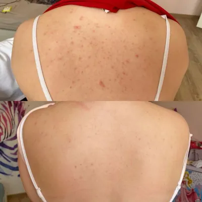 جوانسازی پوست