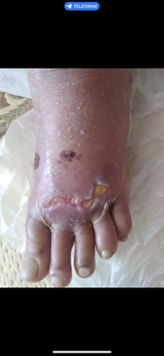 کلینیک زخم در اصفهان