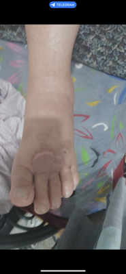 کلینیک زخم در اصفهان