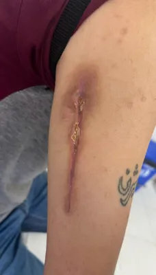 کلینیک زخم در اصفهان