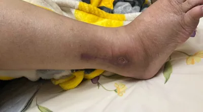 کلینیک زخم در اصفهان