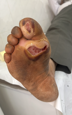 کلینیک تخصصی زخم 