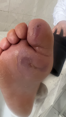 کلینیک تخصصی زخم در اصفهان 