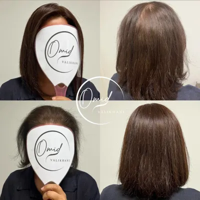 ترمیم مو در فولادشهر