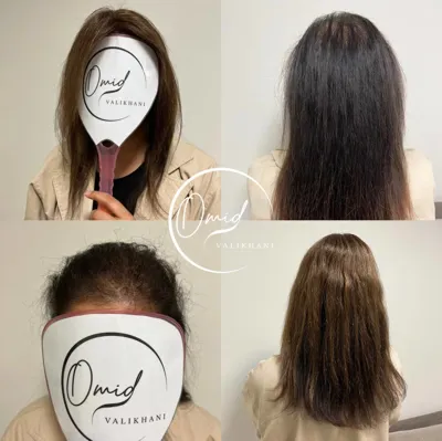 ترمیم مو در فولادشهر