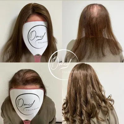 ترمیم مو در فولادشهر