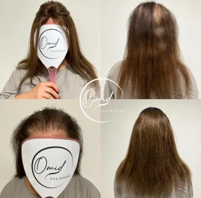 ترمیم مو در فولادشهر