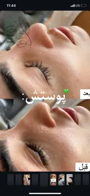 فشیال عالی
