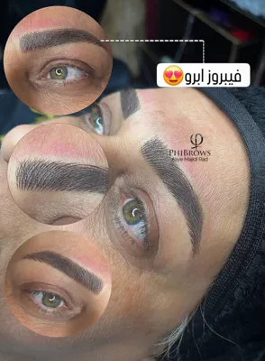 مرکز زیبایی یزد 