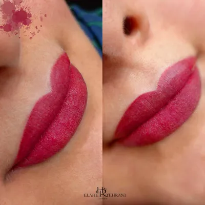 مرکز زیبایی یزد 