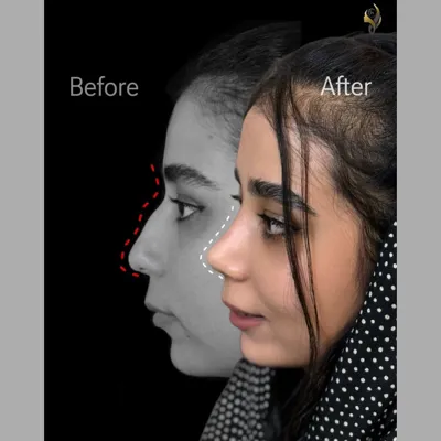 دکتر جراحی بینی در تهران