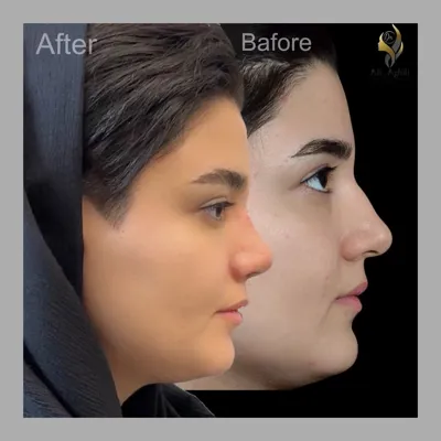 دکتر جراحی بینی در تهران