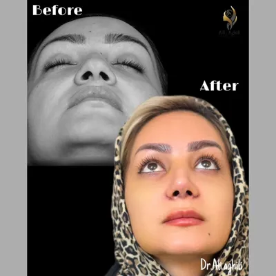 دکتر جراحی بینی در تهران