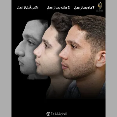 دکتر جراحی بینی در تهران