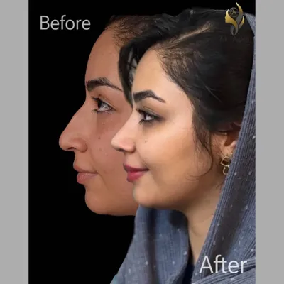 دکتر جراحی بینی در تهران