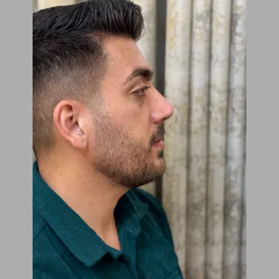 دکتر جراحی بینی در تهران