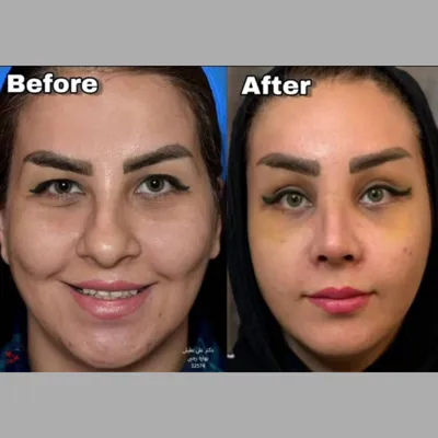 دکتر جراحی بینی در تهران