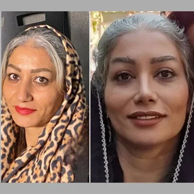 دکتر جراحی بینی در تهران